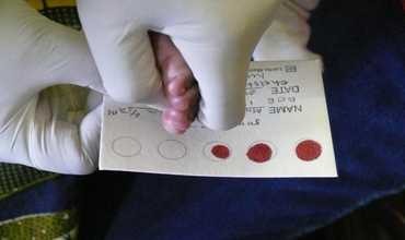 UNICEF y ONUSIDA celebran la noticia del bebé nacido con VIH ahora “funcionalmente curado”