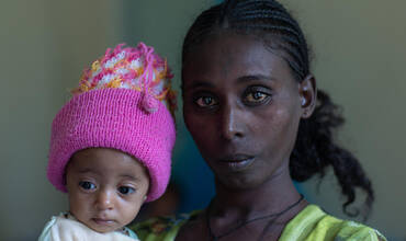 Una madre de Tigray sostiene en brazos a su bebé con desnutrición aguda