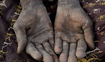 Sahel: la temporada de hambre
