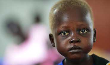 Sudán del Sur: 1 de cada 5 muertos por cólera es niño