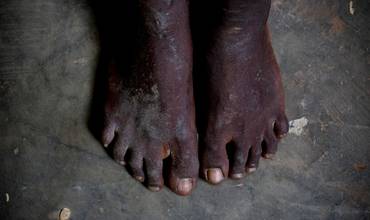 Tres niños muertos en los últimos disturbios en Sudán