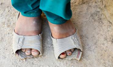 Una niña muestra sus viejos zapatos rotos en Afganistán