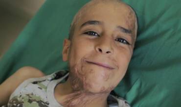 La desgarradora lucha de Hameed contra el cólera en Yemen