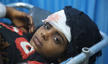 Niños de Yemen: decenas de muertos en un ataque contra un autobús escolar