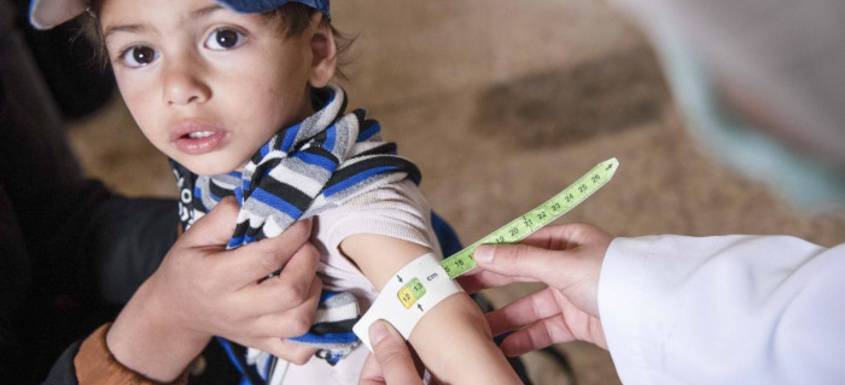 Ishak en un control para detectar la desnutrición aguda.