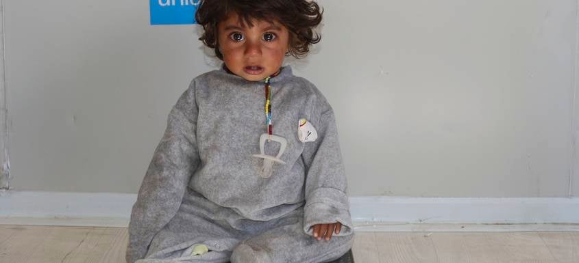 Un bebé es sometido a un examen nutricional en Siria