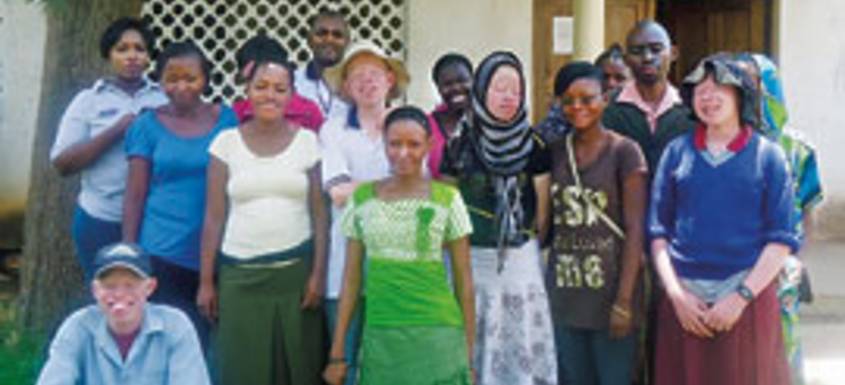 Vivir con albinismo: discriminación y superstición