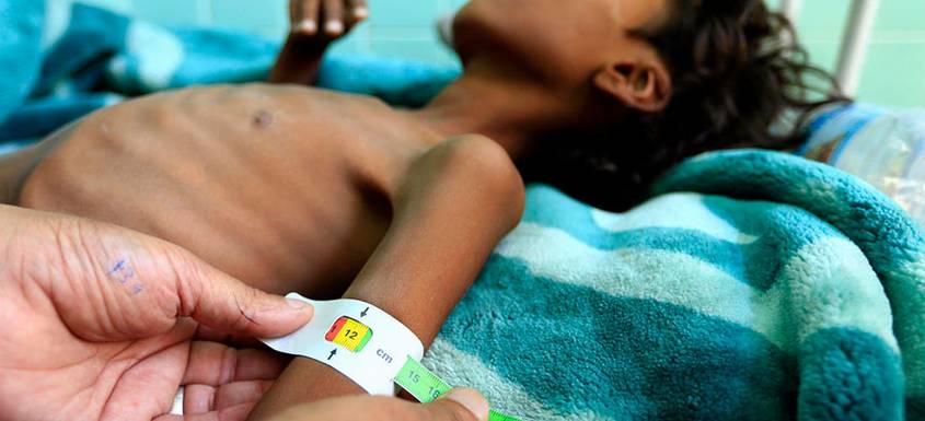 ¿Por qué los niños de Yemen están muriendo de hambre?