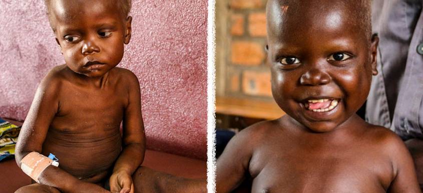 Esta es la prueba de que la desnutrición se puede superar