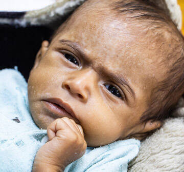 Un bebé en Yemen