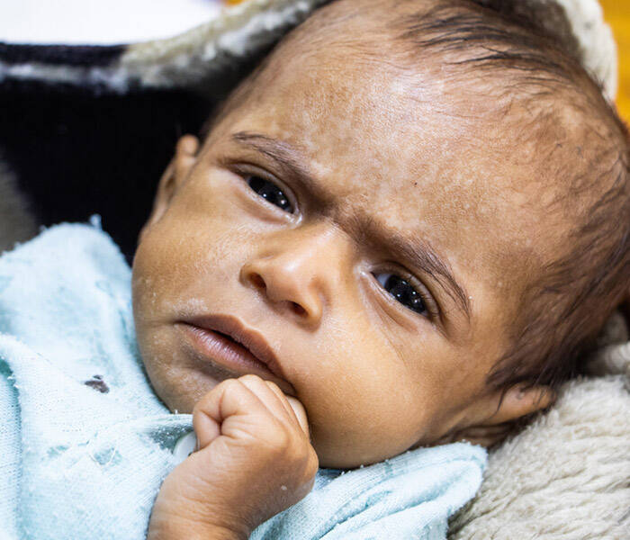 Un bebé en Yemen
