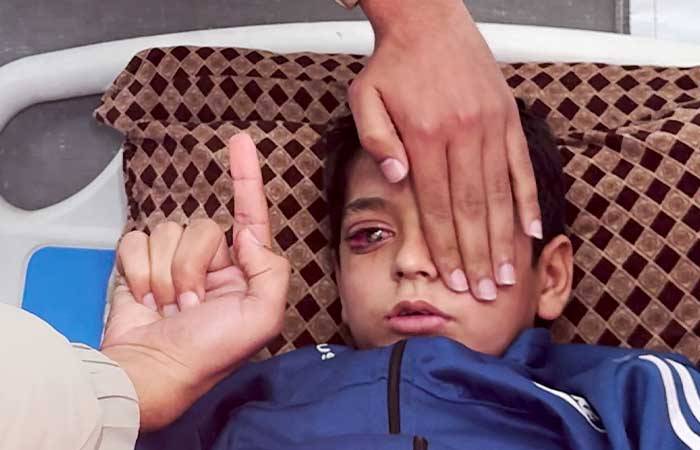 Abid Al Rahman, de nueve años. Estaba recogiendo leña con sus amigos en Jan Yunis cuando un ataque aéreo