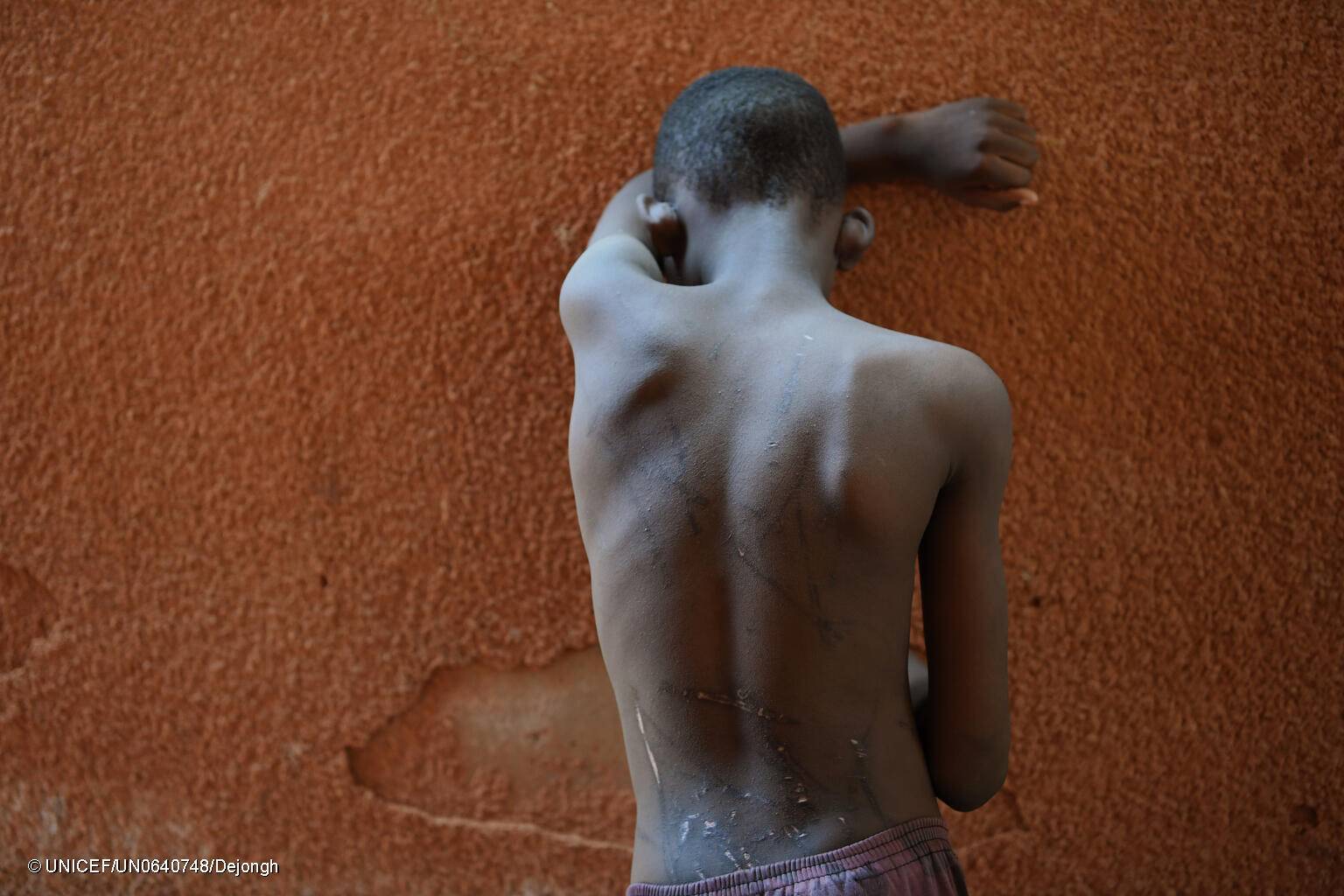 Un niño víctima de violencia doméstica en Burkina Faso