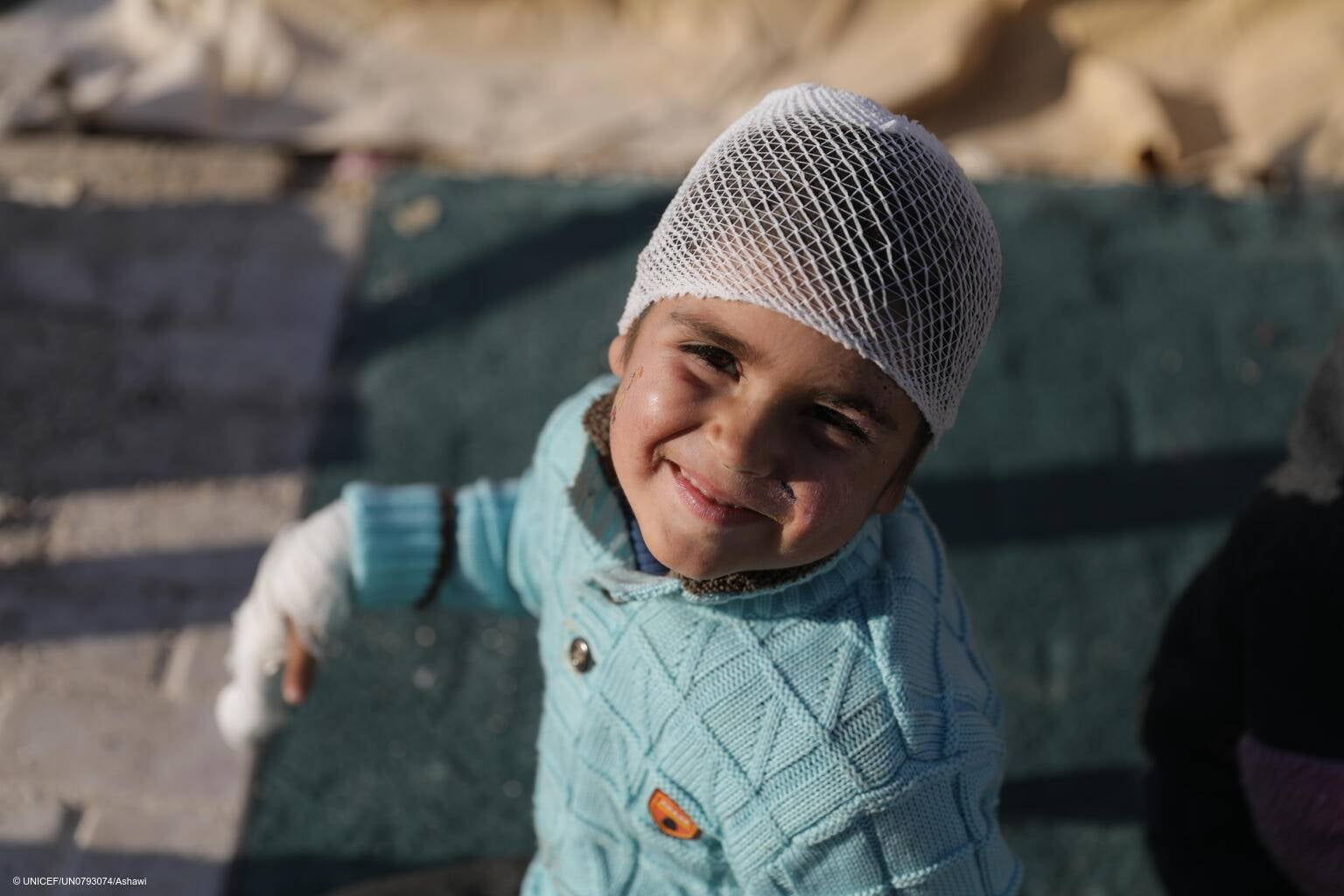 Musa sonriendo mientras se recupera