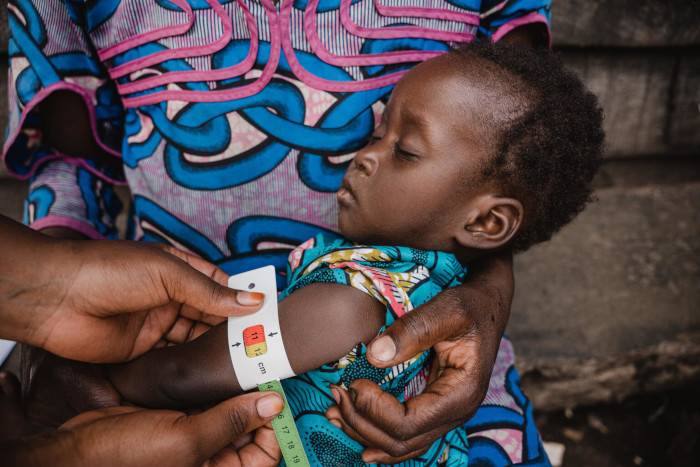 El trabajo de UNICEF con los niños desnutridos de RDC.