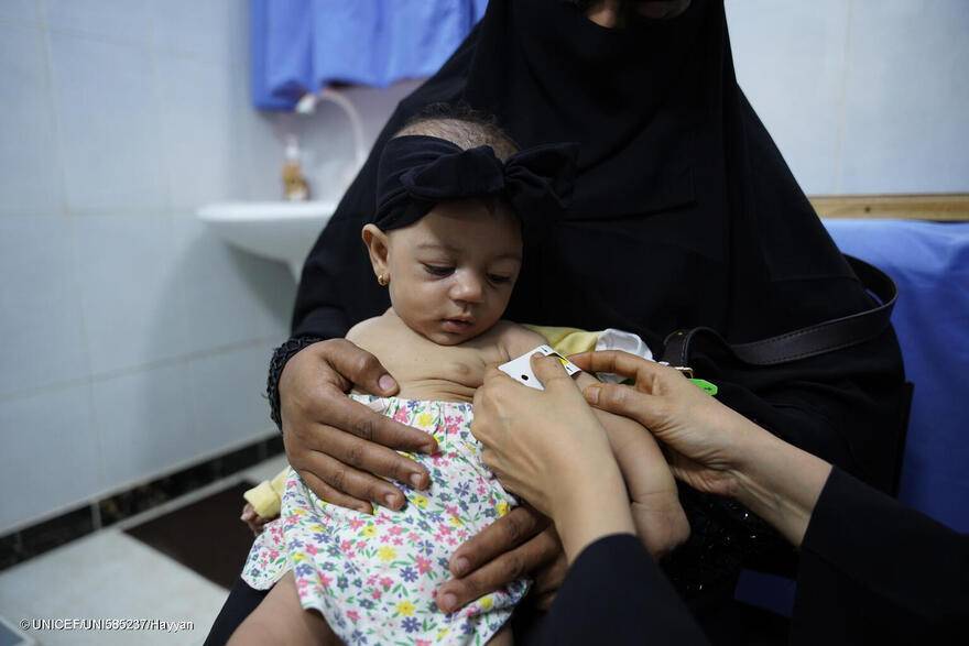 Marwa Saddam, 8 meses. Sufre desnutrición. La examina y trata la Dra. Kamla Ali en un centro de salud de Yemen.