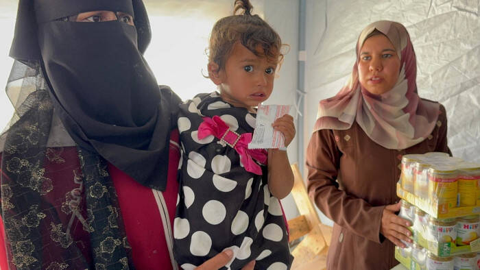 Una niña con alimento terapéutico para tratar su desnutrición.