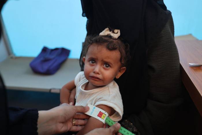 Niños y niñas con desnutrición en Gaza.