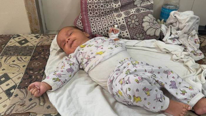 Una niña recibe tratamiento en Gaza.