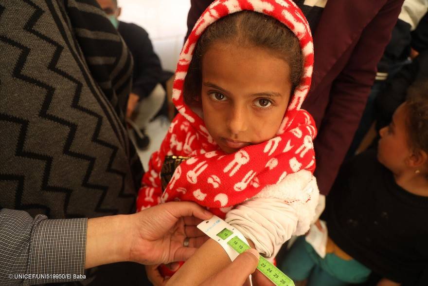 Personal apoyado por UNICEF mide el diámetro de la circunferencia del brazo de una niña de Gaza para determinar si sufre desnutrición