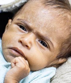 Bebé en Yemen